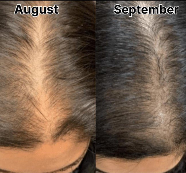 Onion Hair Oil - 250ml Anti-Hairfall Solution