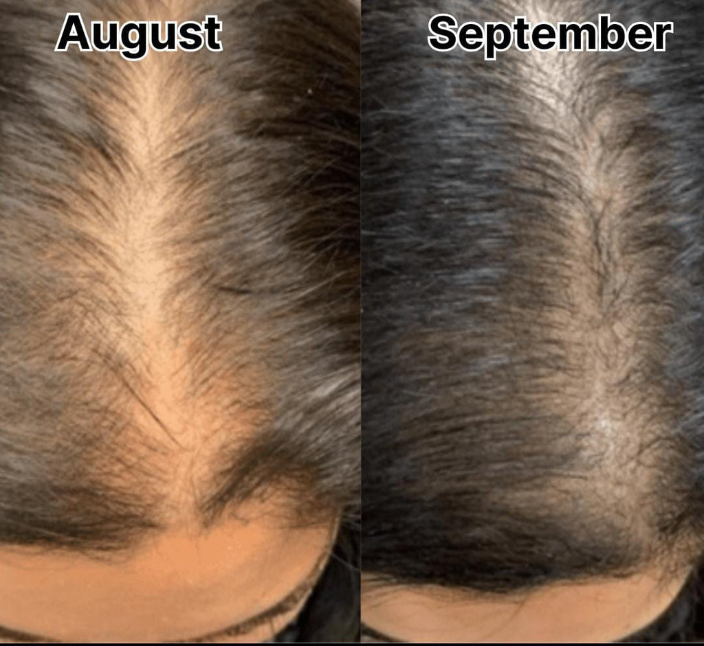 Onion Shampoo - Hair Fall Control and Shine