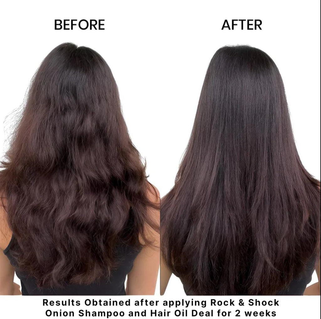 Onion Shampoo + Hair Oil - Combo Pack for Hair Care