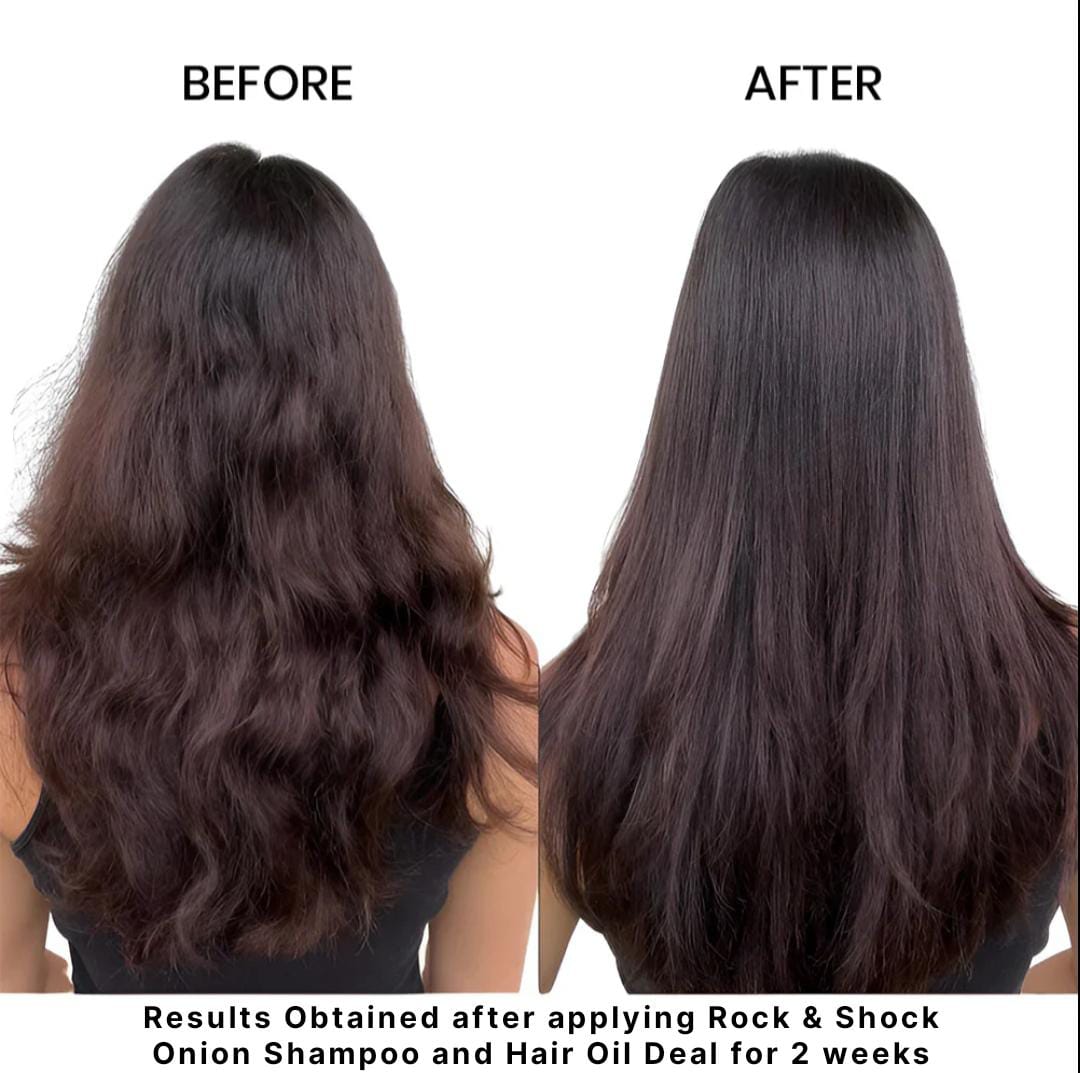 Onion Shampoo + Hair Oil - Combo Pack for Hair Care